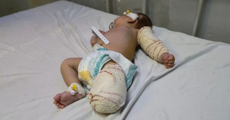 Pejabat Gaza: 22.000 Warga Palestina Butuh Perawatan di Luar Negeri, Minta Evakuasi 1.000 Orang per Hari